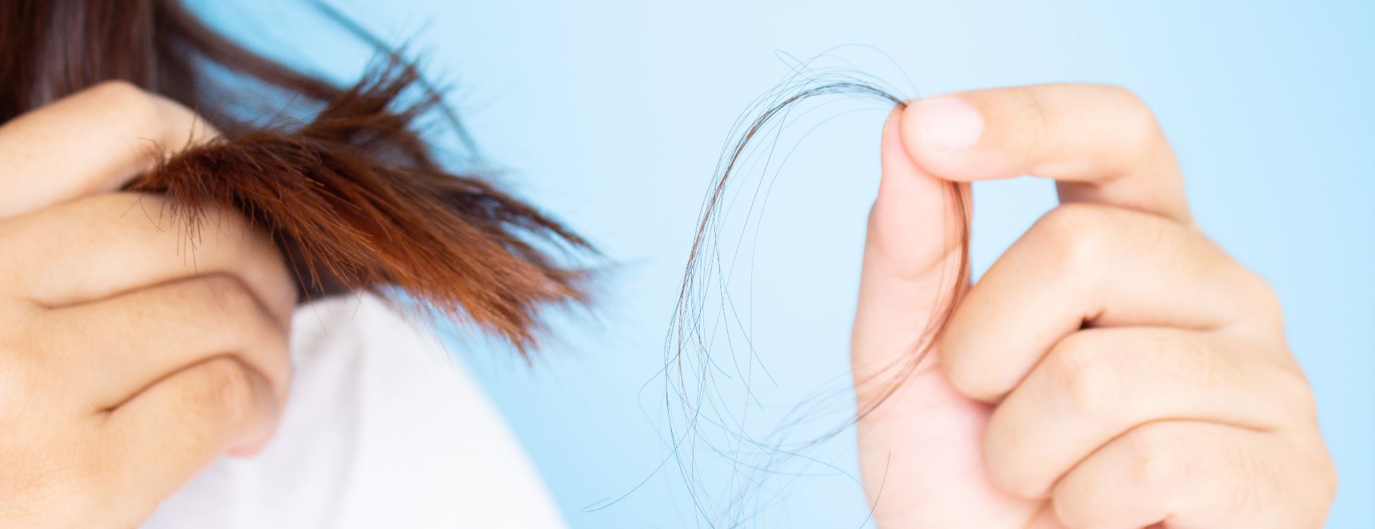 Queda de Cabelo Feminino